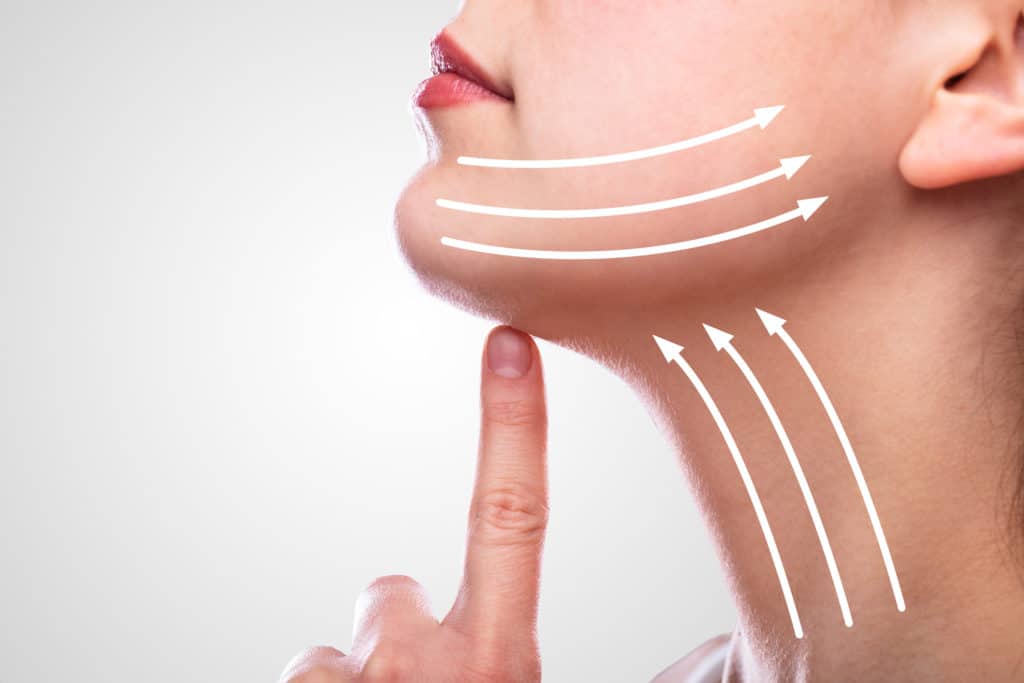 Woman With Arrows On Her Face To Illustrate A Neck Lift Over White Background